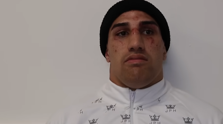 จัสทิส ฮูนิ – คิกิ โทอา เลาเทเล ถูกยกเลิก แทนที่ด้วย แม็กซ์ แมคอินไทร์ – เจด มอร์ริส